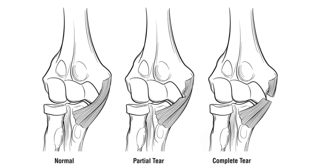 Sports Med Review